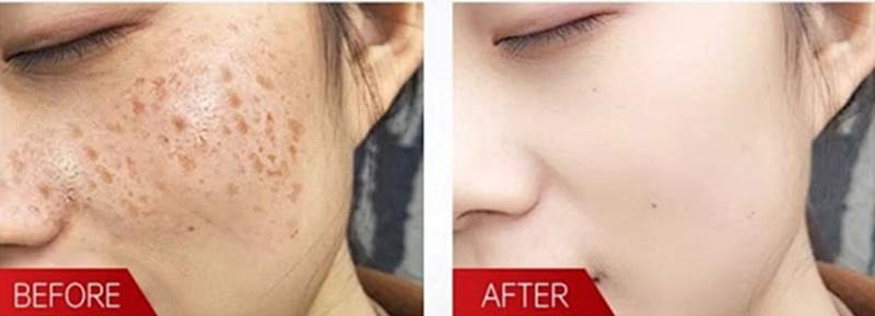 Whitening and Moisturizing Lotion